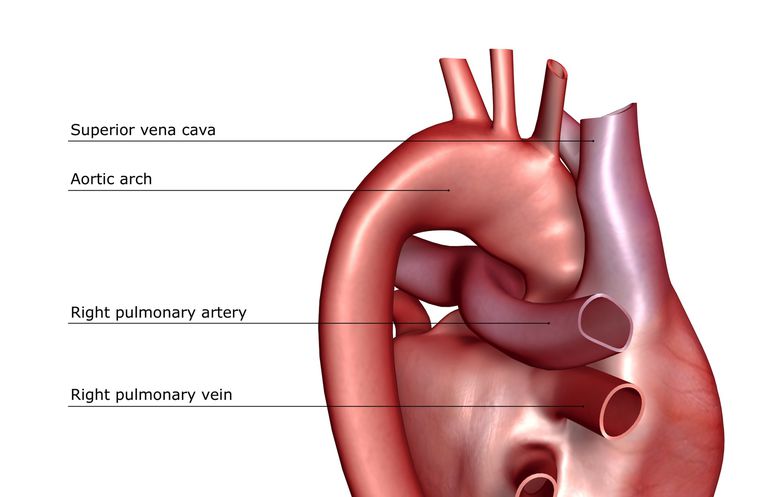 pulmonară este, artera pulmonară, arterială pulmonară, hipertensiune arterială