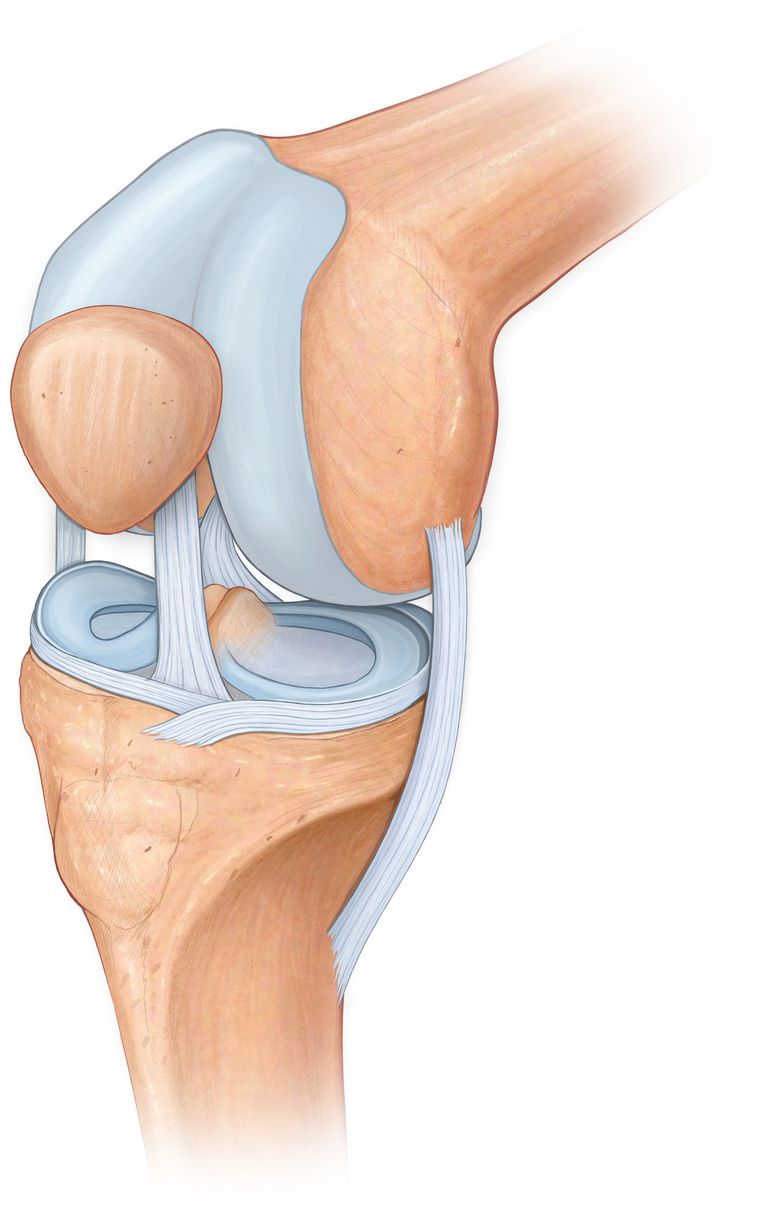 Cartilajul articular, articular poate, Cartilajul hialin, cartilajului articular, articular este, articulația afectată