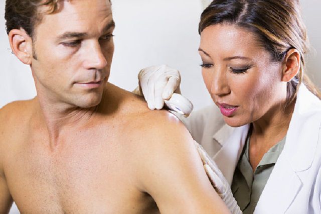 cancer piele, cancerul piele, piele este, asiatici Latine, cancer piele non-melanom