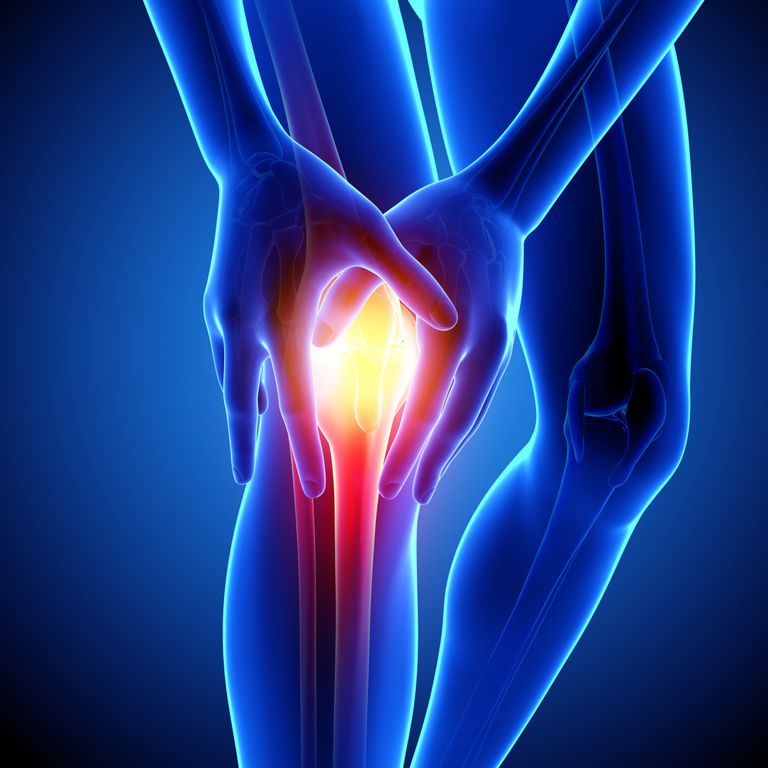artrodeza este, avea probleme, chirurgicală înlocuire, efectuată pentru, genunchiului devin