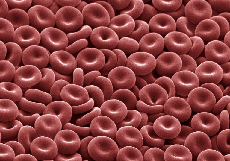 celule roșii, măduva osoasă, poate provoca, provoca anemie, poate provoca anemie, sanguine sănătoase