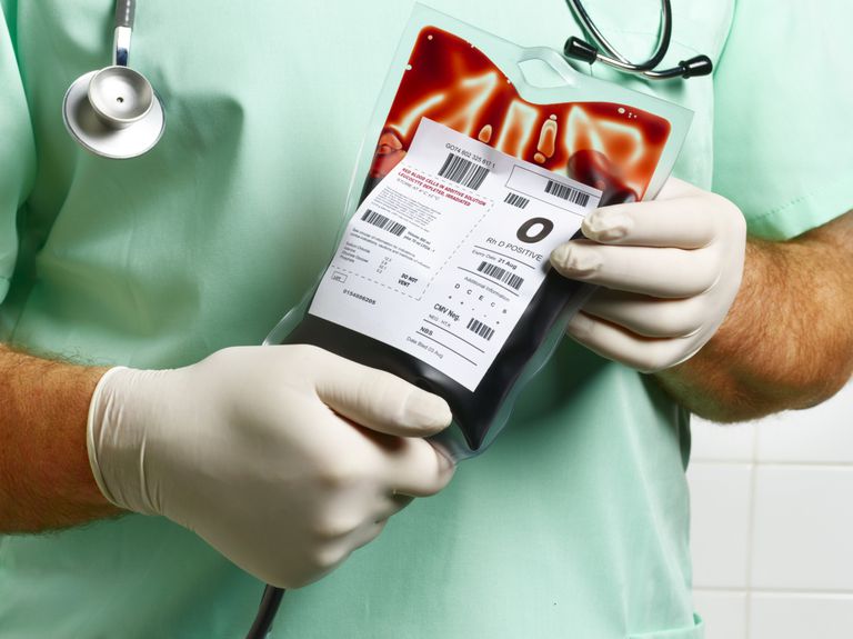 donarea sânge, intervenția chirurgicală, propriul sânge, donarea sânge preoperator, intervenții chirurgicale, Mulți pacienți