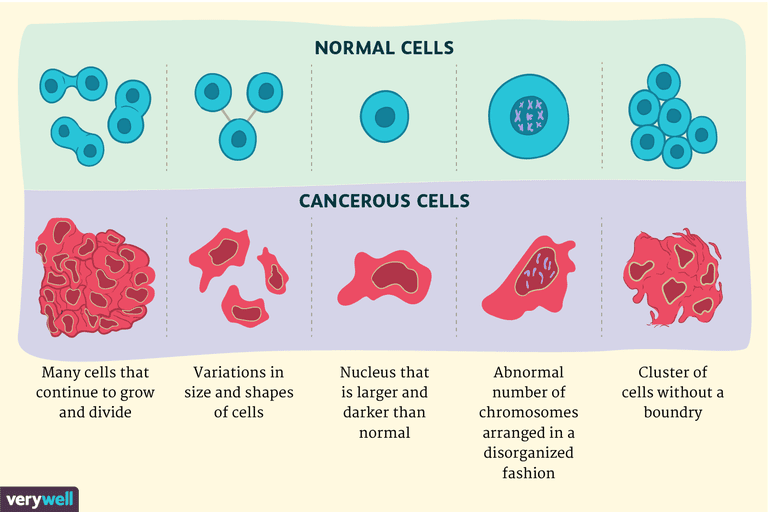 celulele normale, celulelor canceroase, care sunt, canceroase celulele, celulele canceroase, celulele canceroase celulele