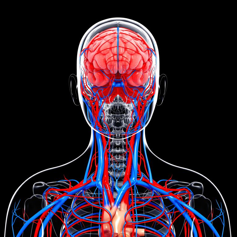 arterei carotide, vascular cerebral, accident vascular, accident vascular cerebral