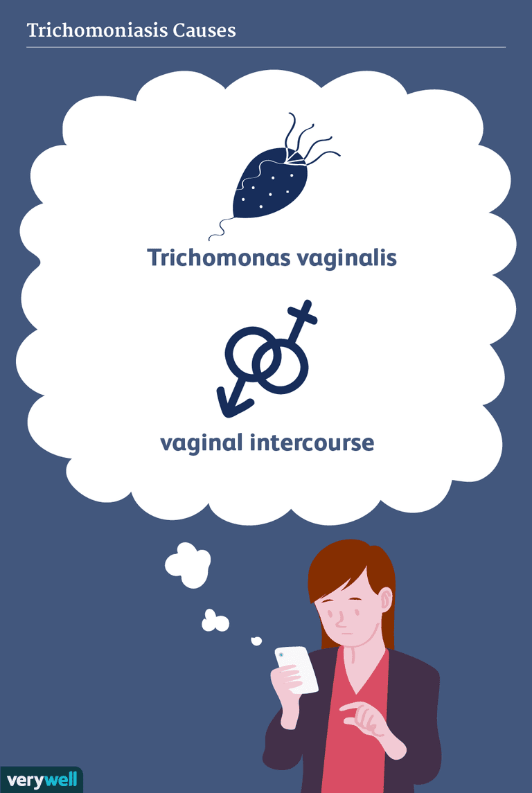 transmitere sexuală, transmis prin, Trichomonas vaginalis