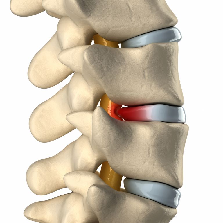 canalului central, canalul spinal, coloanei vertebrale, nervului spinal, rădăcinile nervului