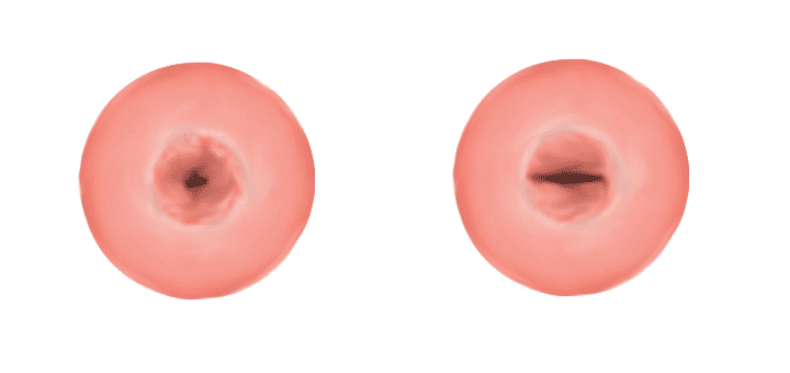 colului uterin, două părți, este deschiderea