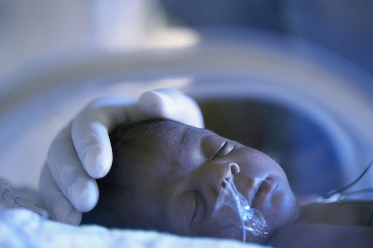 pulmonară cronică, copiii prematuri, după naștere, Bebelușii avea, boala pulmonară