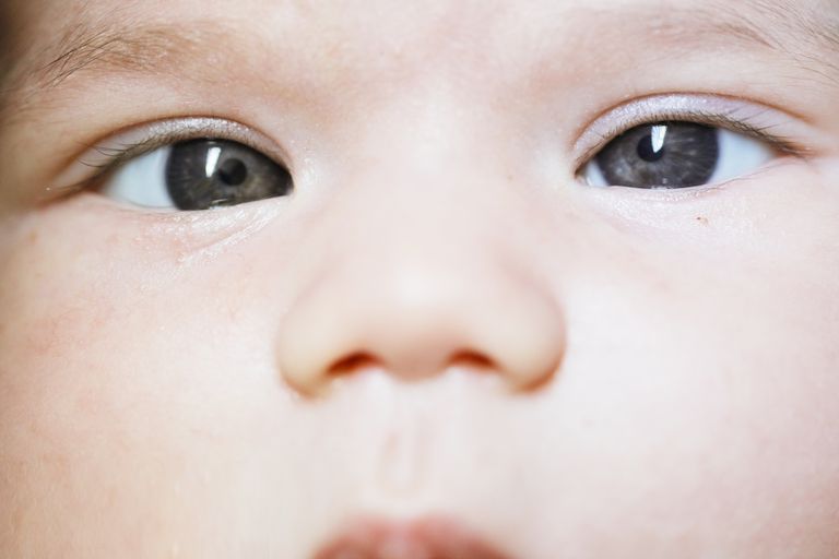 este normal, dacă copilul, Dacă este, Este normal ochii, mușchilor ochiului, normal ochii