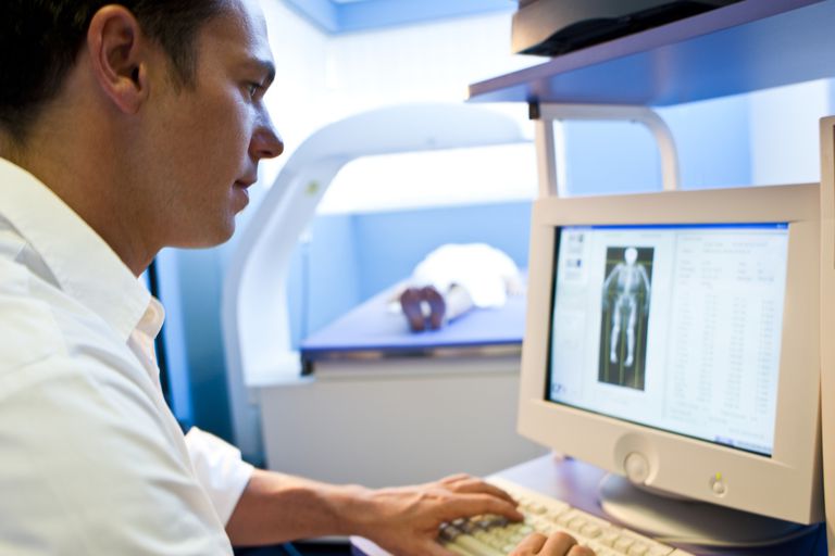 scanare DEXA, densitatea osoasă, pentru osteoporoză, coloanei vertebrale, factori risc