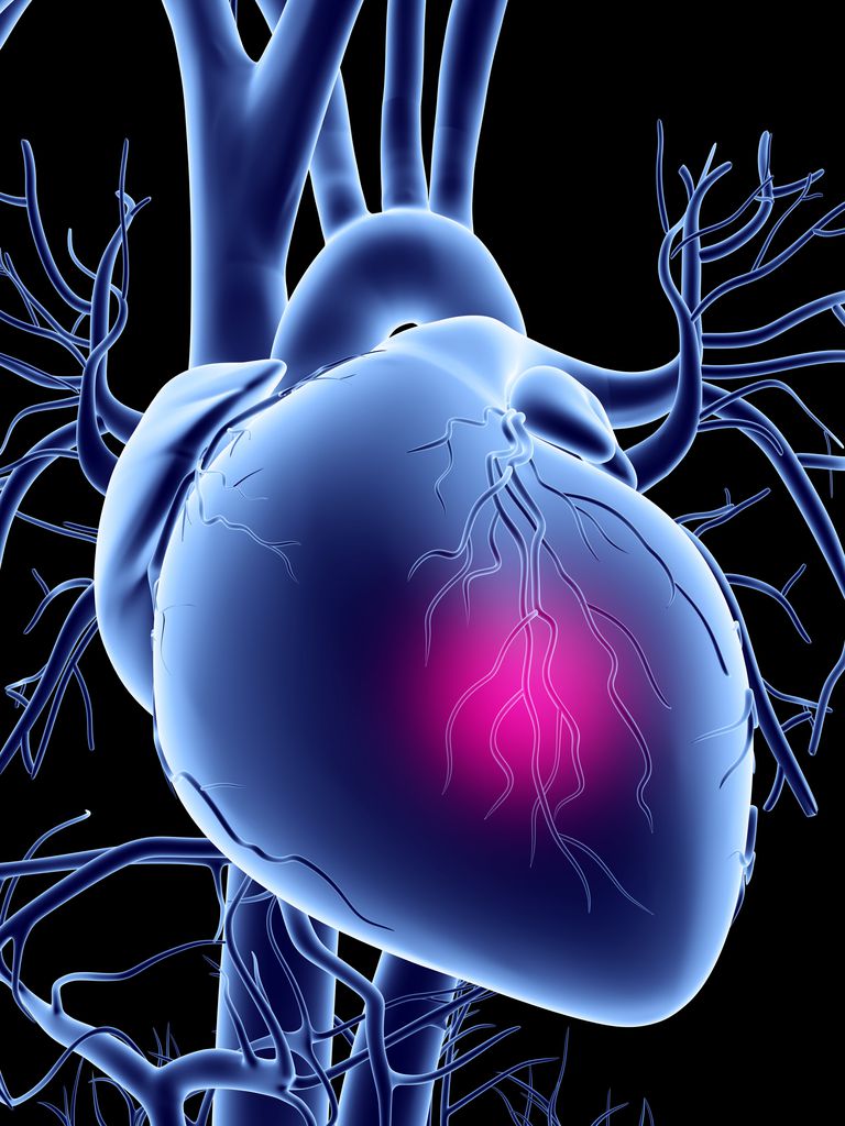 arterele coronare, arterei coronare, Citiți despre, arterelor coronare, blocaje semnificative