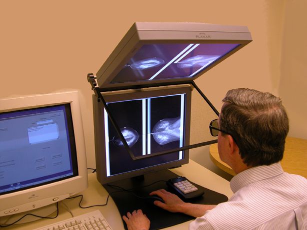 mamografie digitală, digitală este, este disponibilă, Institutul Național, mamografia digitală