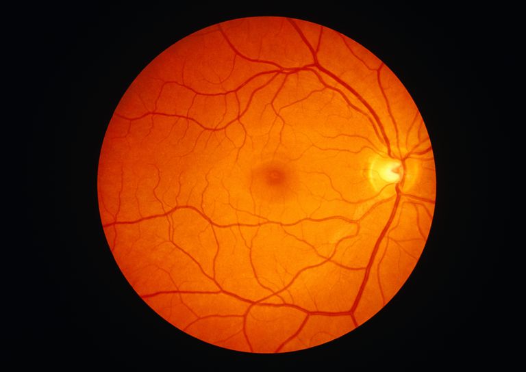 digitală retinei, Imagistica digitală, interiorului ochiului, medici ochi
