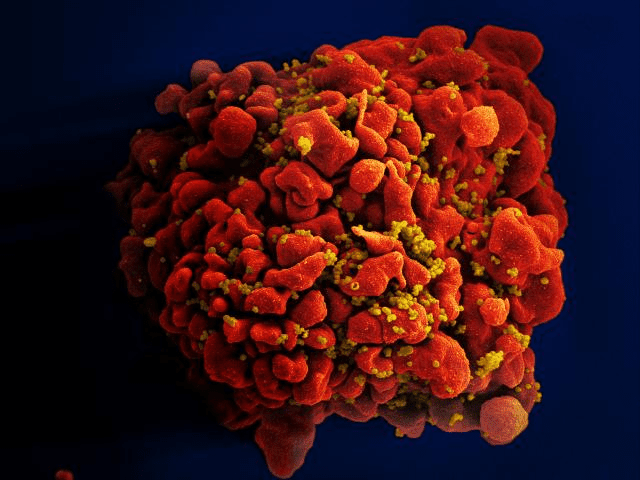 SIDA este, sistemul imunitar, imunitar organismului, Acest lucru, acronimul pentru, care sistemul
