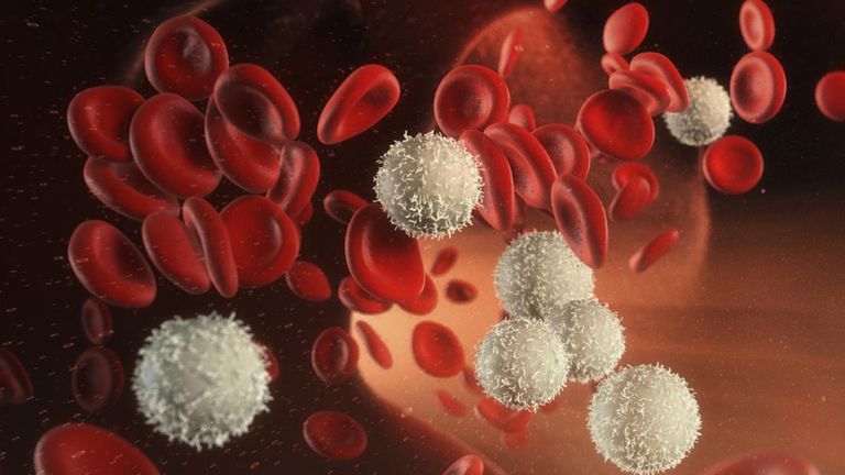 roșii sânge, albe sânge, celule albe, anemia este, care sunt, celule albe sânge