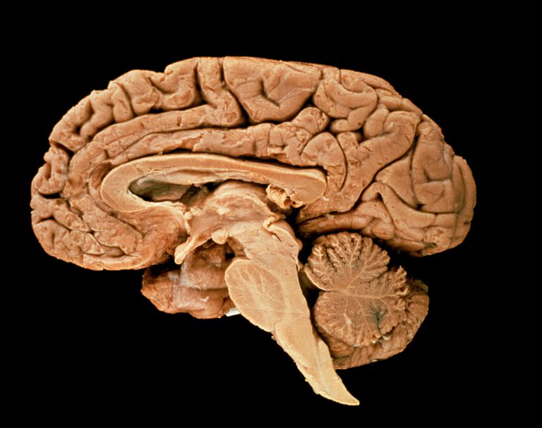 creierului este, Stemul creierului, responsabil pentru, afectează Stemul