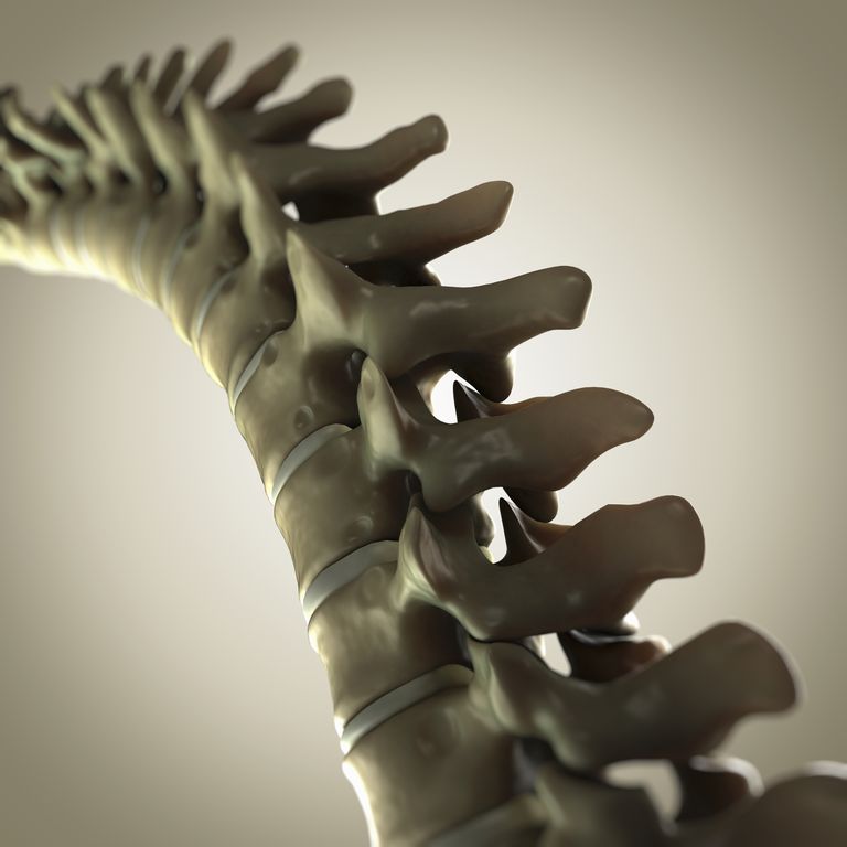 coloanei vertebrale, articulații intervertebrale, ajută stabilizarea, care fost, este dată, fuziune spinării
