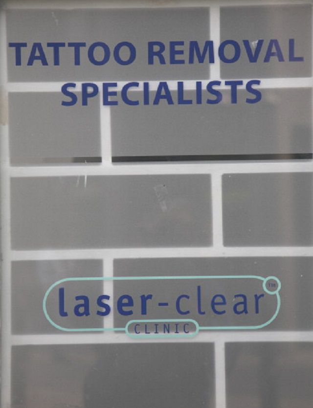 tatuajelor laser, despre îndepărtarea, îndepărtarea tatuajelor, îndepărtarea tatuajelor laser, multe despre, despre îndepărtarea tatuajelor