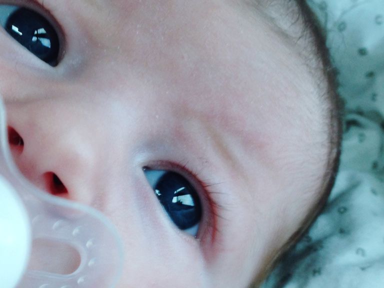 după naștere, infecții oculare, poate provoca, bebelușul dumneavoastră