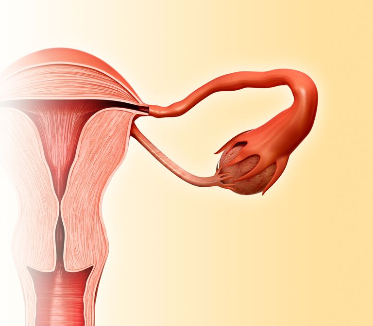 această procedură, cancerului ovarian, Efectele secundare, femei aleg, ovarele pentru