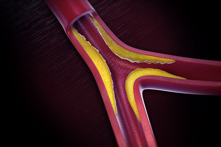 membrul afectat, artera piciorului, arterele care, arterele care alimentează, atunci când, care alimentează