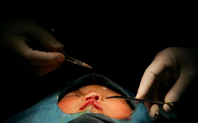 chirurgia cosmetică, chirurgie plastică, chirurgiei plastice, Chirurgia chirurgicală, Chirurgia chirurgicală este, Chirurgia cosmica
