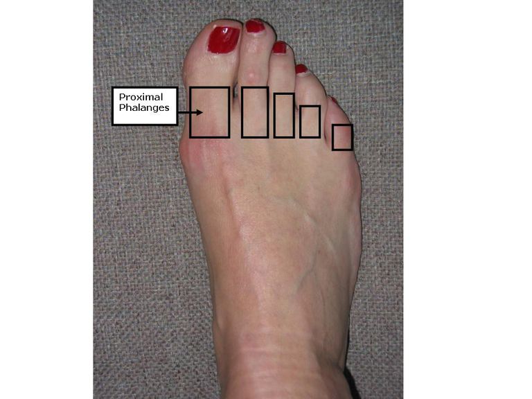degetele picioare, care este, degetul mare, falangiei proximale, articulația metatarsofalangiană
