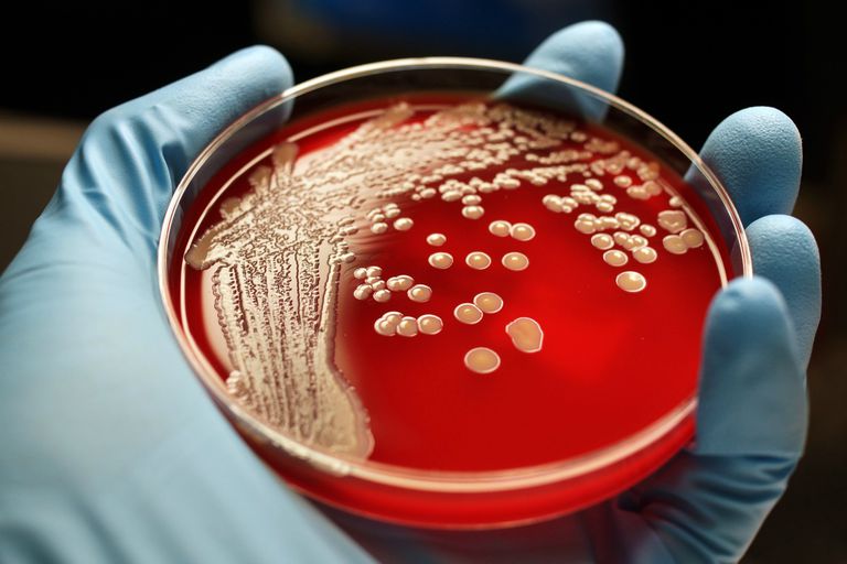 MRSA este, Staphylococcus aureus, altă persoană, altă persoană care, aureus care, care este