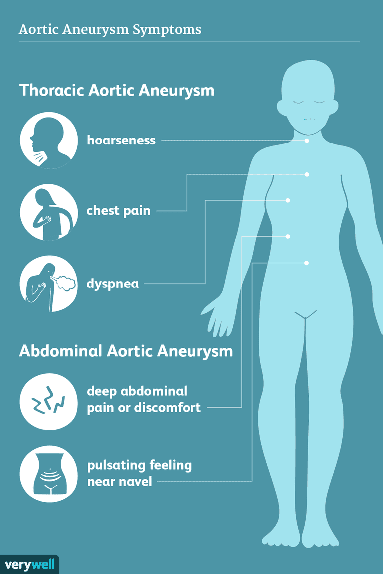 anevrism aortic, aortic abdominal, aortic toracic, anevrism aortei