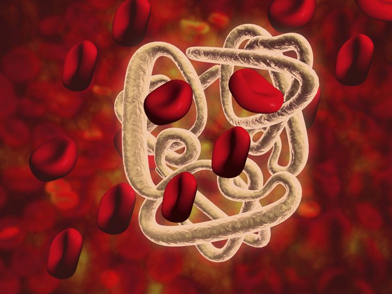 roșii sânge, celule roșii, alfa talasemie, anemia este, celule roșii sânge, lanțuri beta