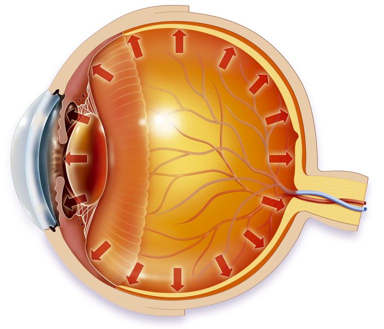 intervenția chirurgicală, presiunea ochiului, canalul drenaj, care presiunea, chirurgia laser