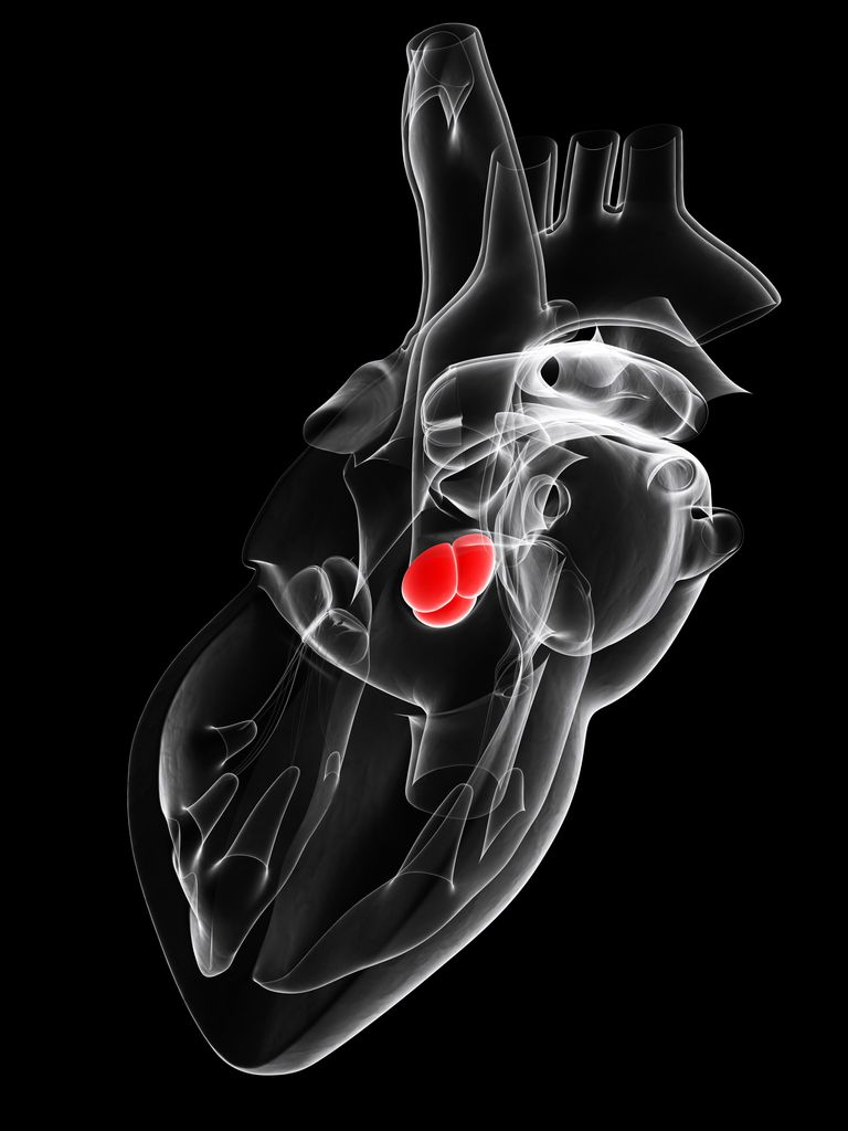 valvei aortice, TAVI este, stenoză aortică, cord deschis, intervenția chirurgicală