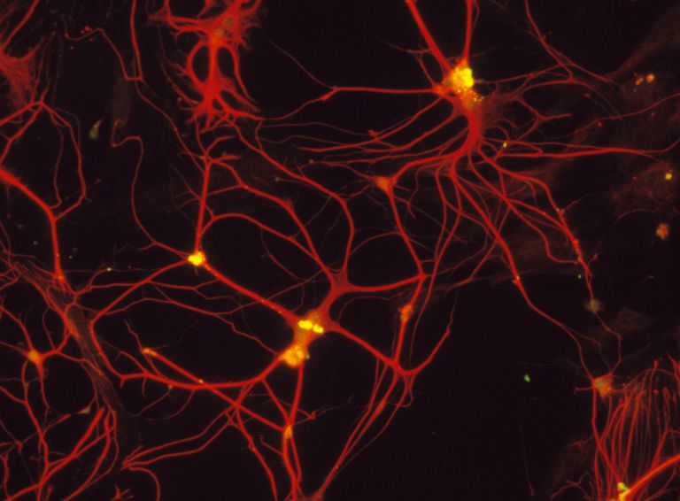 nervos central, care este, care sunt, celule gliale