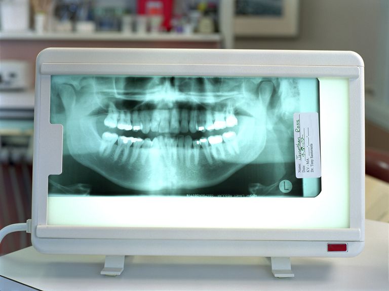 dentare ortodontice, unei persoane, înregistrările dentare, sunt folosite, înregistrările dentare ortodontice, asemenea utilizate