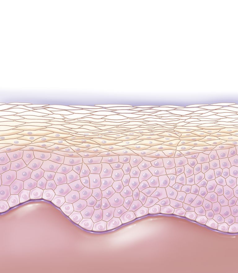 celule pielii, pielii sunt, predispuși acnee, Aceste celule, acestor factori