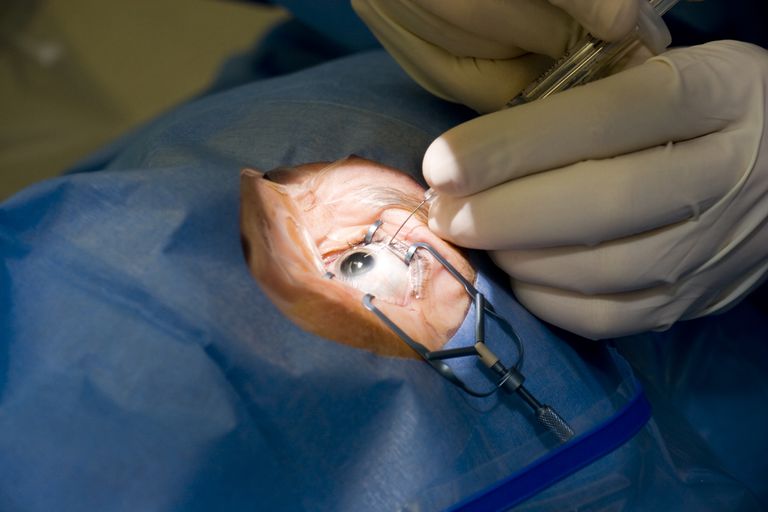 întârzia cataracta, pentru cataracta, poate deveni, Simptomele cataractei, tipuri cataractă, unei cataracte