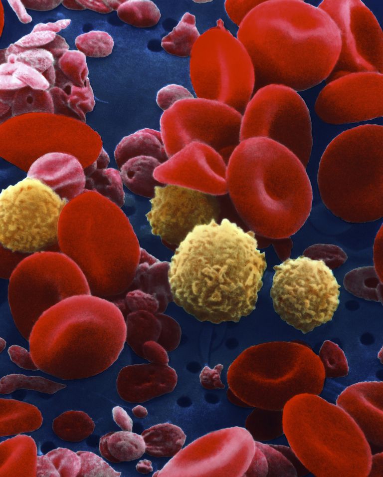 roșii sânge, celule roșii, celulelor roșii, crescut cancer, osoasă poate, albe sânge