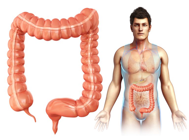 cancer colon, cazurile cancer, colonul este, lungime aproximativ, aproximativ centimetri, cazurile cancer colon