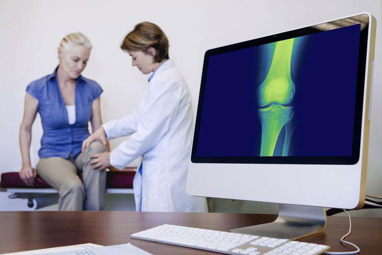 medicul dumneavoastră, totală genunchiului, cele trei, înlocuirea totală, înlocuirea totală genunchiului, osteoartrita genunchiului