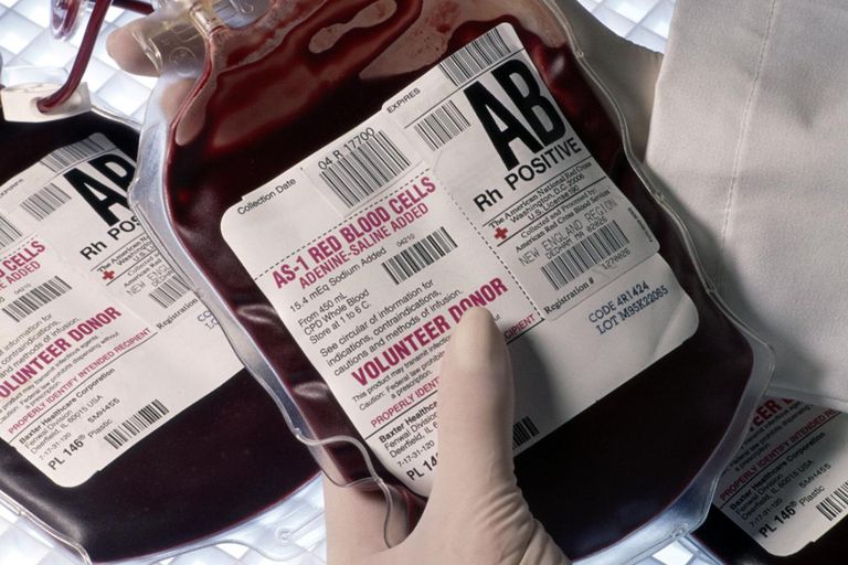 sânge este, transfuzie sânge, orice sânge, tipurile sânge, destinatar universal
