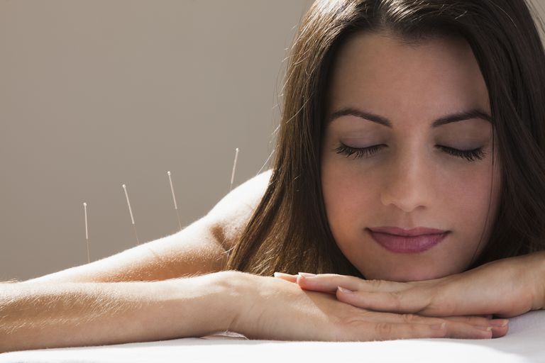 arătat acupunctura, lucru este, Acupunctura pentru, beneficiile potențiale, care utilizează, multe studii