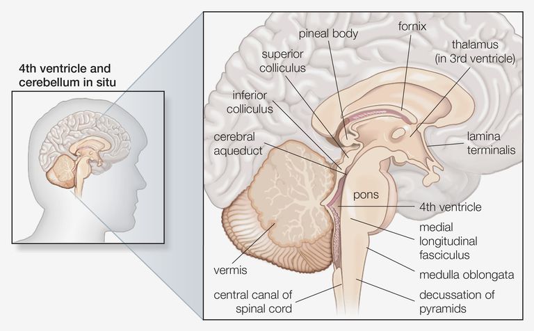 vascular cerebral, accident vascular cerebral, accident vascular, cerebral medular, vascular cerebral medular