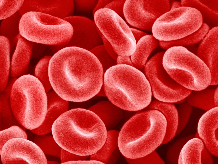 roșii sânge, G6PD este, atunci când, celulele roșii, celulele roșii sânge, celulelor roșii